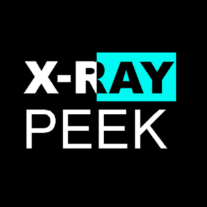 X Ray Peek par Michel